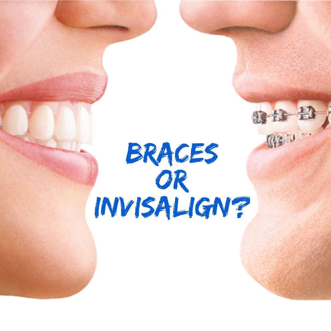 BRACES OR INVISALIGN Pro and con Kempsey Dental Centre